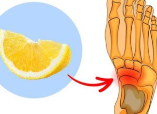 როგორ უნდა გამოვიყენოთ ლიმონის ქერქი ქუსლისა და სახსრების ტკივილის სამკურნალოდ? საინტერესო ინფორმაციაა