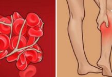 სისხლის გათხელება მედიკამენტების გარეშე, მხოლოდ ნატურალური პროდუქტებით! აიცილეთ თავიდან სისხლის შედედება