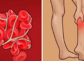 სისხლის გათხელება მედიკამენტების გარეშე, მხოლოდ ნატურალური პროდუქტებით! აიცილეთ თავიდან სისხლის შედედება