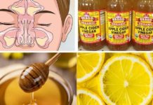 როგორ უნდა გამოვიყენოთ ვაშლის ძმარი სინუსის ინფექციის სამკურნალოდ? ის რამდენიმე წუთში კლავს ინფექციას