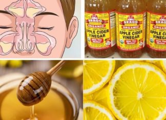 როგორ უნდა გამოვიყენოთ ვაშლის ძმარი სინუსის ინფექციის სამკურნალოდ? ის რამდენიმე წუთში კლავს ინფექციას