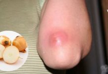 ძირმაგარა გამოგივიდათ და არ იცით როგორ მოიშოროთ? ამაში ხახვი დაგეხმარებათ