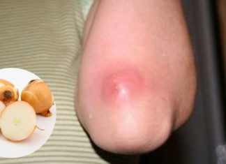 ძირმაგარა გამოგივიდათ და არ იცით როგორ მოიშოროთ? ამაში ხახვი დაგეხმარებათ