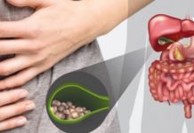 თუ ნაღვლის ბუშტმა შეგვაწუხათ და არ იცით თავს როგორ უშველოთ, ჩვენ გადაგარჩენთ