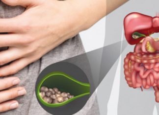 თუ ნაღვლის ბუშტმა შეგვაწუხათ და არ იცით თავს როგორ უშველოთ, ჩვენ გადაგარჩენთ