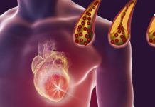 სისხლძარღვების წმენდა ამ მეთოდებით ყველაზე ეფექტურია. გაეცანით რეცეპტებს!