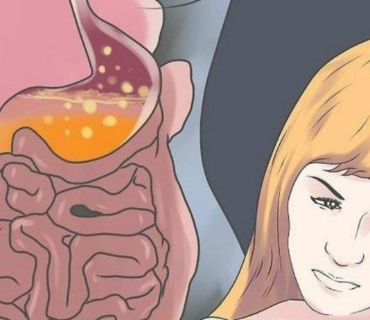 რა სიმპტომები ახასიათებს გულძმარვას? როგორ უმკლავდება ამ პრობლემას ხალხური მედიცინა?