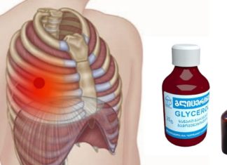 Როგორ ვუმკურნალოთ ნეკნთაშუა ნევრალგიას? ძალიან მარტივი რეცეპტი ბევრს დაეხმარა ამ დაავადების სამუდამოდ დამარცხებაში