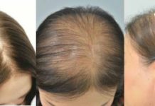 თმის ცვენა აღარ შეგაწუხებთ, თუ სახლში ამ ნიღაბს მოამზადებთ. აუცილებლად სცადეთ!