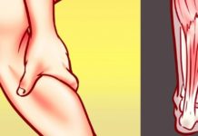 ფეხების შეშუპებას ამ რეცეპტით უმკურნალებთ და სამუდამოდ დაივიწყებთ მისით გამოწვეულ დისკომფორტს.