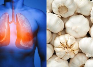 გაიწმინდეთ ფილტვები ნიორის დახმარებით. აი რეცეპტიც!