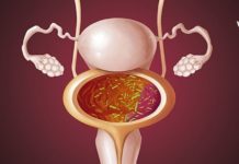 ცისტიტი ერთ-ერთი ყველაზე მტკივნეული და უსიამოვნო დაავადებაა – ხალხური მედიცინის რეცეპტები მარტივად აგვარებს ამ პრობლემა