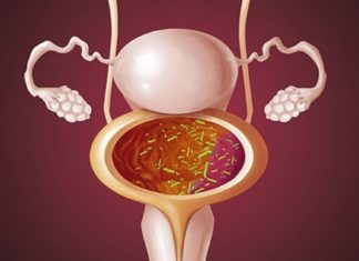 ცისტიტი ერთ-ერთი ყველაზე მტკივნეული და უსიამოვნო  დაავადებაა – ხალხური მედიცინის რეცეპტები მარტივად აგვარებს ამ პრობლემა