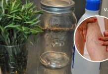 მოამზადეთ როზმარინის და სპირტის ნაყენი, რომ სამუდამოდ გათავისუფლდეთ ვარიკოზული ვენებისგან