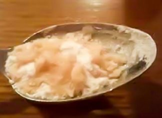 გაწუხებთ სახსრების ტკივილი? ან რადიკულიტი? ოსტეოქონდროზი, ართრიტი, ართროზი? სამკურნალოდ გამოიყენეთ ხალხური საშუალება – წაისვით შინ დამზადებული მალამო