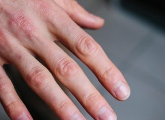 ხელის კანი გისკდებათ და გიუხეშდებათ? ჩვენ გასწავლით უებარ საშუალებას