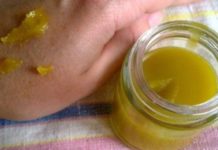 დინდგელის ეს მალამო საოცარია დამწვრობის, ნაწოლების და სხვა მსგავსი პრობლემების დროს. გასწავლით როგორ უნდა მოამზადოთ