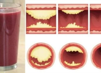 თქვენს არტერიებს ეს უგემრიელესი წვენი გაწმენდს და გულის დაავადებებისგანაც დაგიცავთ!