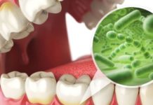 თუ პირის უსიამოვნო სუნი დისკომფორტს გიმქნით და არ იცით რა მოიმოქმედოთ, მაშინ ეს სტატია თქვენთვისაა