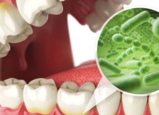 თუ პირის უსიამოვნო სუნი დისკომფორტს გიმქნით და არ იცით რა მოიმოქმედოთ, მაშინ ეს სტატია თქვენთვისაა