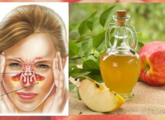 ეს ყველასათვის კარგად ნაცობი პროდუქტი სინუსურ ინფექციას ყველაზე ეფექტურად უმკლავდება!