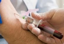 როგორ უნდა უმკურნალოთ პროთრომბინის მომატებას? მოემზადეთ ეს წამლები