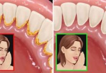 4 უტყუარი მეთოდი პირადან უსიამოვნო სუნის გასაქრობად. წაიკითხეთ და გათავისუფლდით!