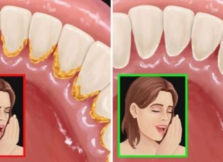 4 უტყუარი მეთოდი პირადან უსიამოვნო სუნის გასაქრობად. წაიკითხეთ და გათავისუფლდით!