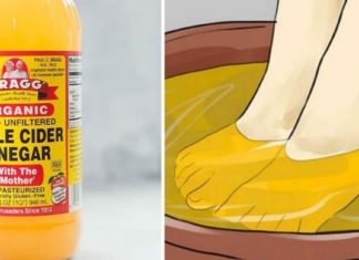 ჩააწყვეთ ფეხები ძმარში კვირაში ერთხელ და ყველანაირი ტკივილი გაგივლით.