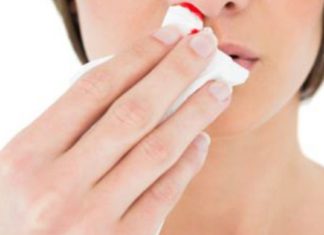 პატარაოდან მუდამ მტანჯდავდა ცხვირიდან სისხლდენა, ერთხელაც ეს დისკომფორტი დასრულდა. დღეს გაგიზიარებთ, თუ  როგორ მოვახერხე