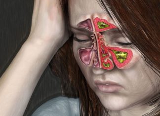 გამოიყენეთ ეს რეცეპტები და ჰაიმორიტი აღარ შეგაწუხებთ