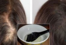 აი რა უნდა იცოდეთ – თმის მოვლის 3 რჩევა აბუსალათინის ზეთის შესახებ