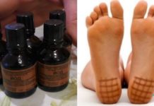 რატომ უნდა წავისვათ იოდი ქუსლებზე ღამით – ეს უნდა იცოდეთ!