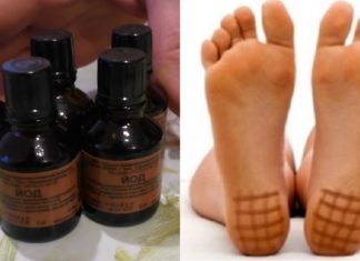 რატომ უნდა წავისვათ იოდი ქუსლებზე ღამით – ეს უნდა იცოდეთ!