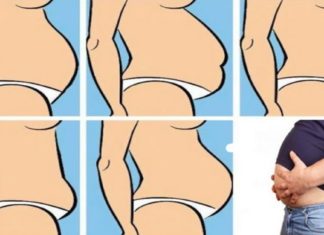 5 ტიპის მუცელი და მათი მოშორების მეთოდები… წაიკითხე და გაილამაზე შენი ცხოვრება!