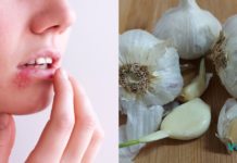 “არ მეგონა თუ ჰერპესს ერთ დღეში გავიქრობდი”! ეს რეცეპტი ყველამ უნდა სცადოთ!