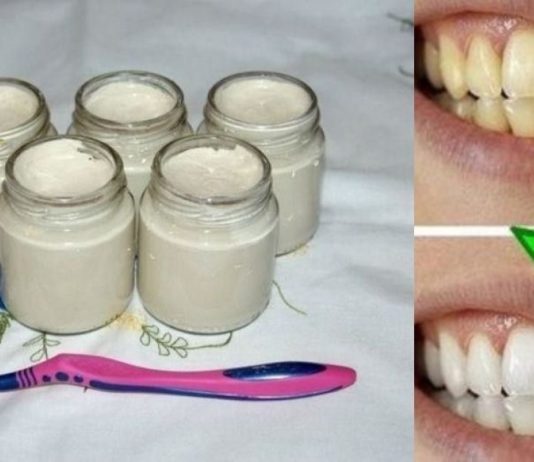 აღარასდროს იყიდოთ კბილის პასტა!! უახლესი კვლევის შედეგები: სოდას და ქოქოსის კარაქს საუკეთესო შედეგი აქვს!!