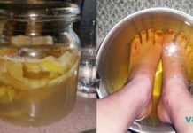 ფრჩხილის სოკოს სამკურნალო ინგრედიენტი სახლში გვქონია !! ასე სოკოს 2 დღეში მოიშორებთ… ფეხები ძმარში