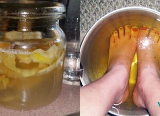 ფრჩხილის სოკოს სამკურნალო ინგრედიენტი სახლში გვქონია !! ასე სოკოს 2 დღეში მოიშორებთ… ფეხები ძმარში