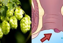 განიკურნეთ ვარიკოზისგან მხოლოდ 1 ინგრედიენით – ის საოცარი თვისებებით გამოირჩევა!