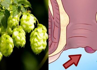 განიკურნეთ ვარიკოზისგან მხოლოდ 1 ინგრედიენით – ის საოცარი თვისებებით გამოირჩევა!