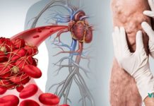 “ამ პროდუქტებმა ჩემი სიცოცხლე გადაარჩინეს”! ნახეთ რეცეპტი, რომელიც თრომბის საშიშროებას თავიდან აგარიდებთ!