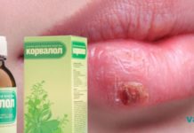 თუ გაწუხებთ ჰერპესი, ეს რეცეპტი თქვენთვისაა! ძალიან ეფექტურია!