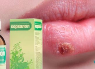 თუ გაწუხებთ ჰერპესი, ეს რეცეპტი თქვენთვისაა! ძალიან ეფექტურია!