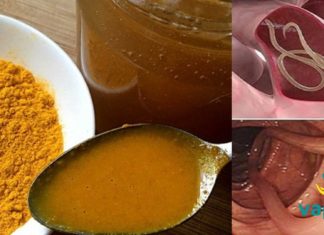 სასწაული სასმელი პარაზიტების დროს! 1 ჭიქა და დაემშვიდობეთ ვერაგ პარაზიტებს!