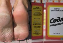 დაემშვიდობეთ დახეთქილ ქუსლებს! ეს რეცეპტი დრომ გამოსცადა და ხალხი შოკში ჩააგდო.