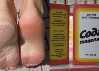 დაემშვიდობეთ დახეთქილ ქუსლებს! ეს რეცეპტი დრომ გამოსცადა და ხალხი შოკში ჩააგდო.