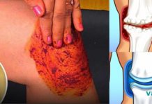 ხალხი გიჟდება ამ რეცეპტზე! რადგან ის სრულფასოვნად კურნავს მუხლის, ძვლებისა და სახსრების ტკივილს!