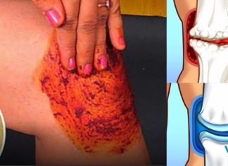 ხალხი გიჟდება ამ რეცეპტზე! რადგან ის სრულფასოვნად კურნავს მუხლის, ძვლებისა და სახსრების ტკივილს!