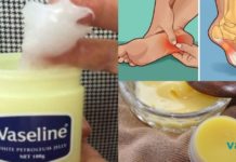 ეს პროდუქტები ყველას მოგეპოვებათ სახლში! მოიხსენით ქუსლებზე დაღლილობა სულ რაღაც 1 წუთში რამდენიმე ინგრედიენტის დახმარებით!